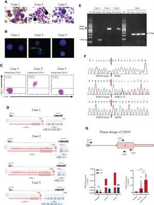 Recurrent Novel P2RY8/IGH Translocations in B-Lymphoblastic Leukemia/Lymphoma